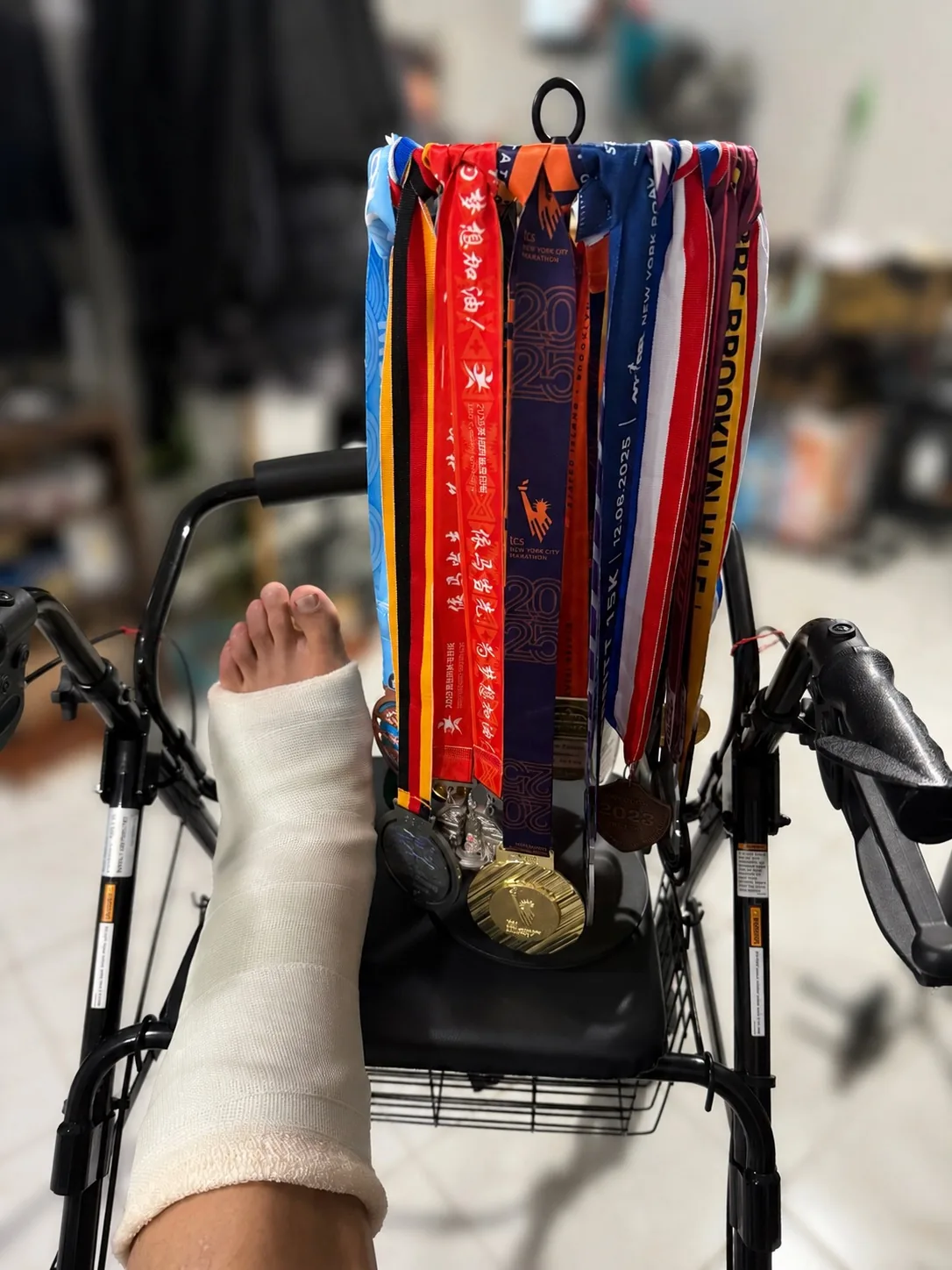 A casted leg next to race medals after the 2026 injury
